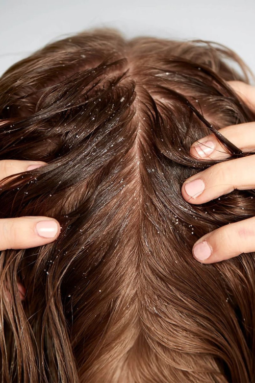 oily hair